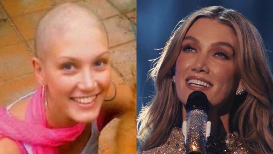 Delta Goodrem: Τι είναι το λέμφωμα Hodgkin που «χτύπησε» την εκπρόσωπο της Αυστραλίας στα 18 της - Ο γάμος υπερπαραγωγή το 2025 στην Μάλτα (Φωτογραφίες)