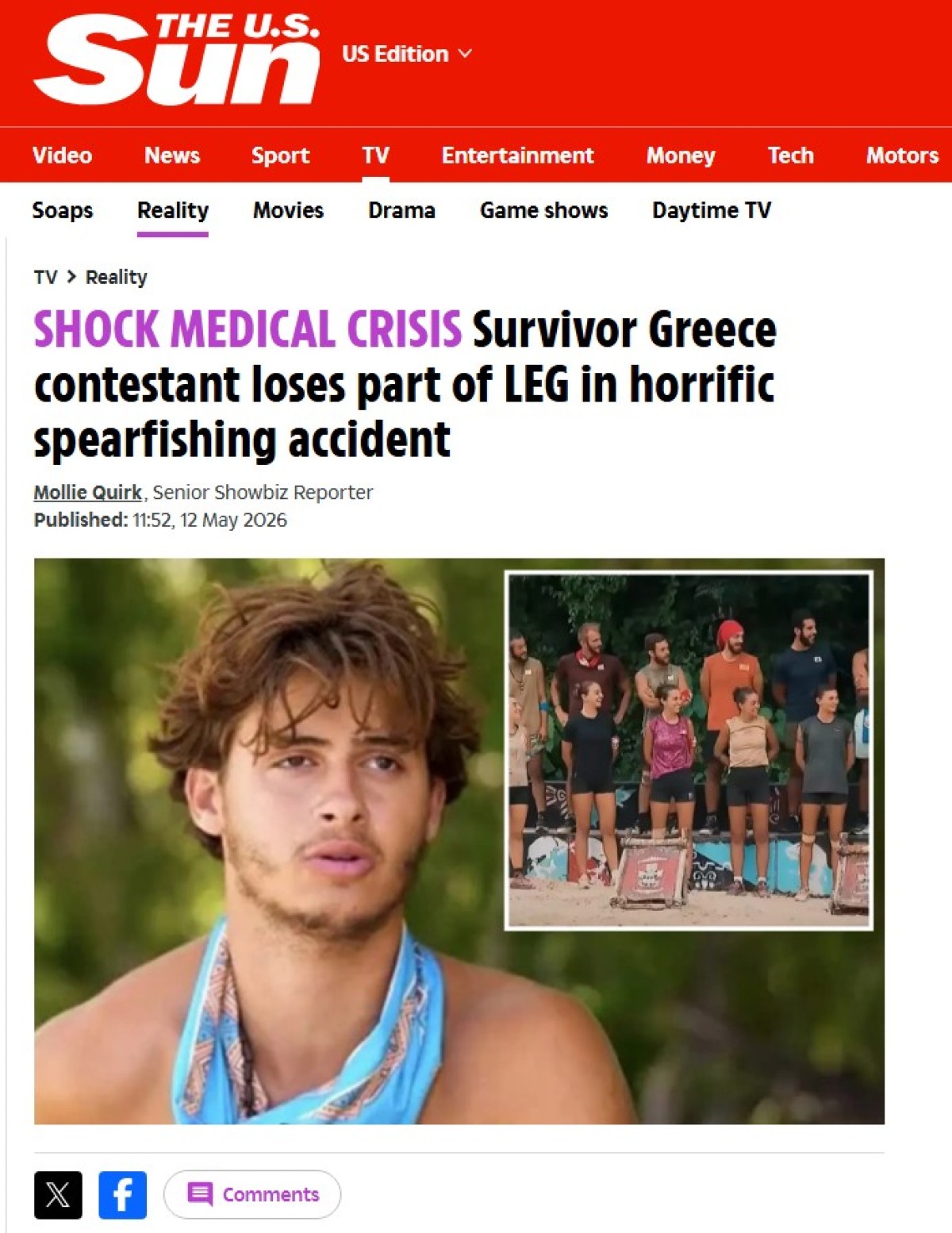 Survivor: Πρωτοφανές! Η τραγωδία με τον Φλώρο κάνει τον γύρο του κόσμου – Οι τίτλοι σοκ στα ξένα μέσα για την Ελλάδα