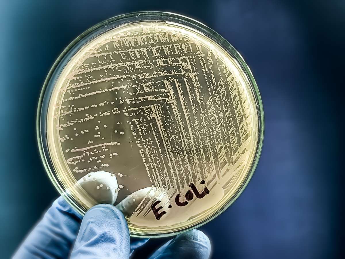E.coli