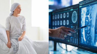 Αύξηση καρκίνου θεραπεία σε γυναίκα