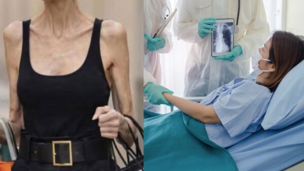 Ενέσεις αδυνατίσματος και υγεία